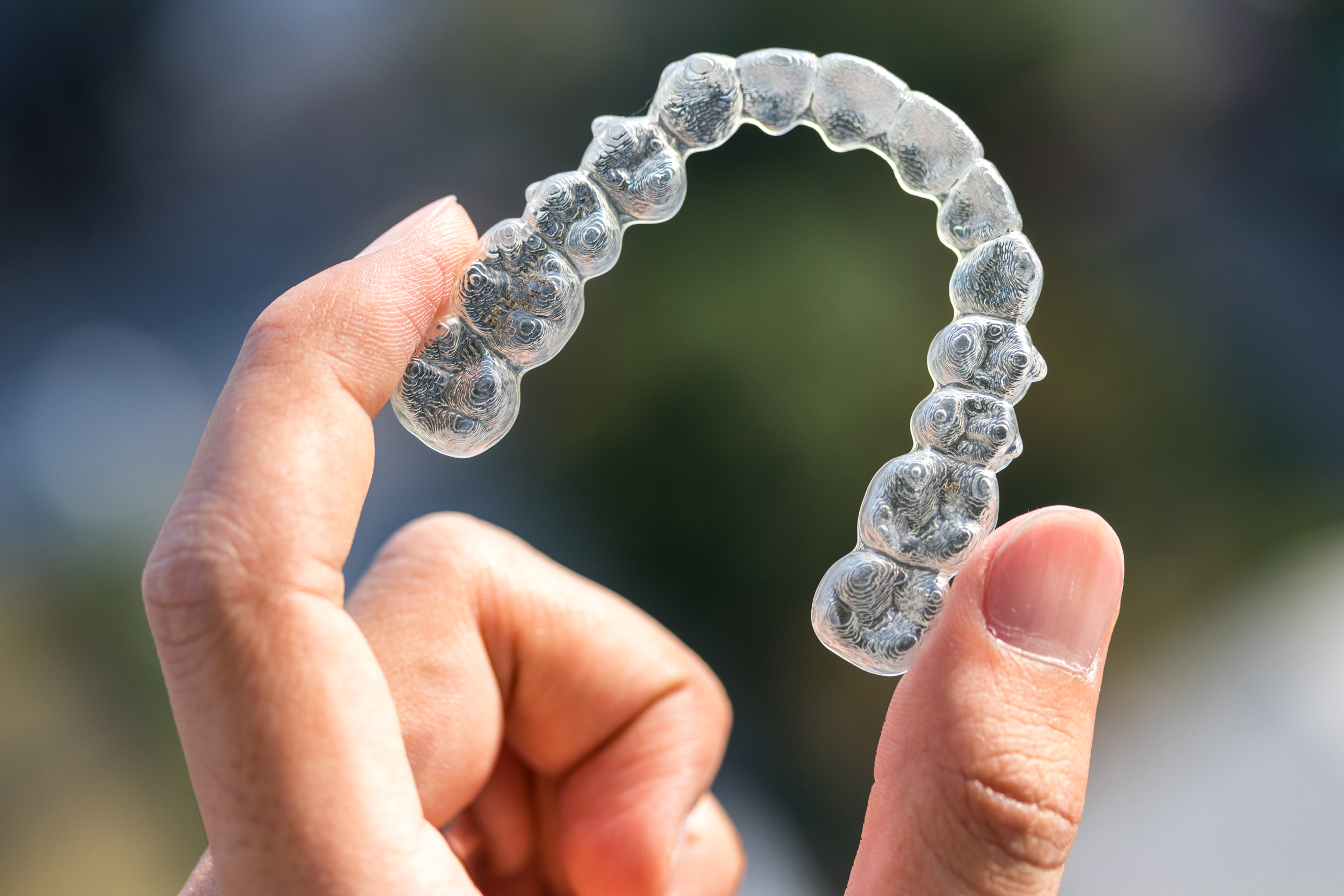 Shopping-Is-It-Worth-It-Invisalign